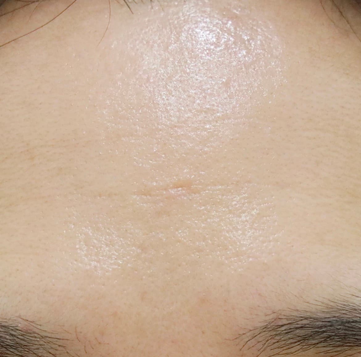 Calm clear skin