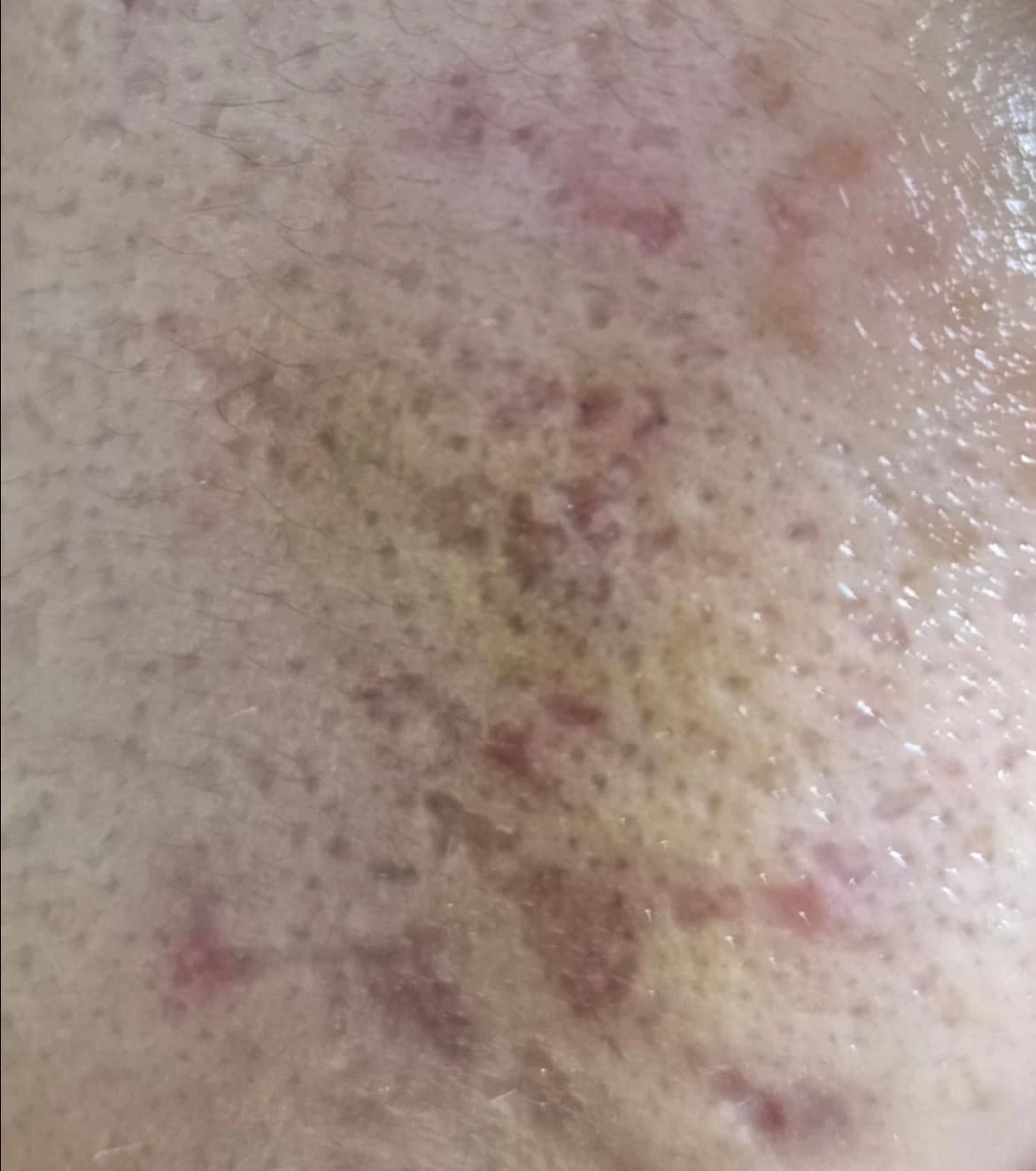 Member progress photo