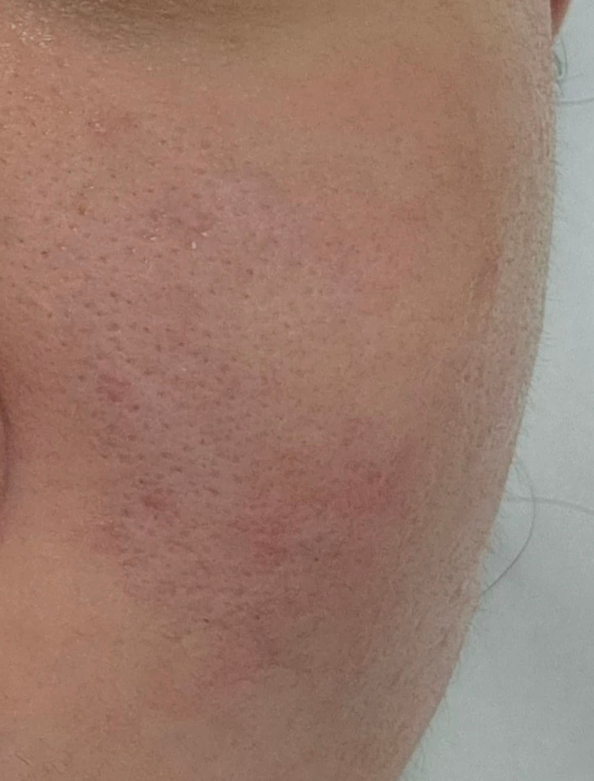 Member progress photo