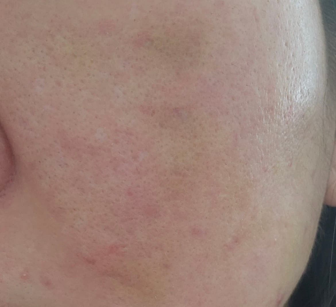 Member progress photo